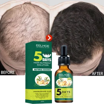  5 Дни Джинджифил Средства За Растежа На Косата Лечение На Косопад Етерично Масло От Суроватка Бързо Развиващи Сухи Къдрава Изтощена Коса Ремонт Грижи